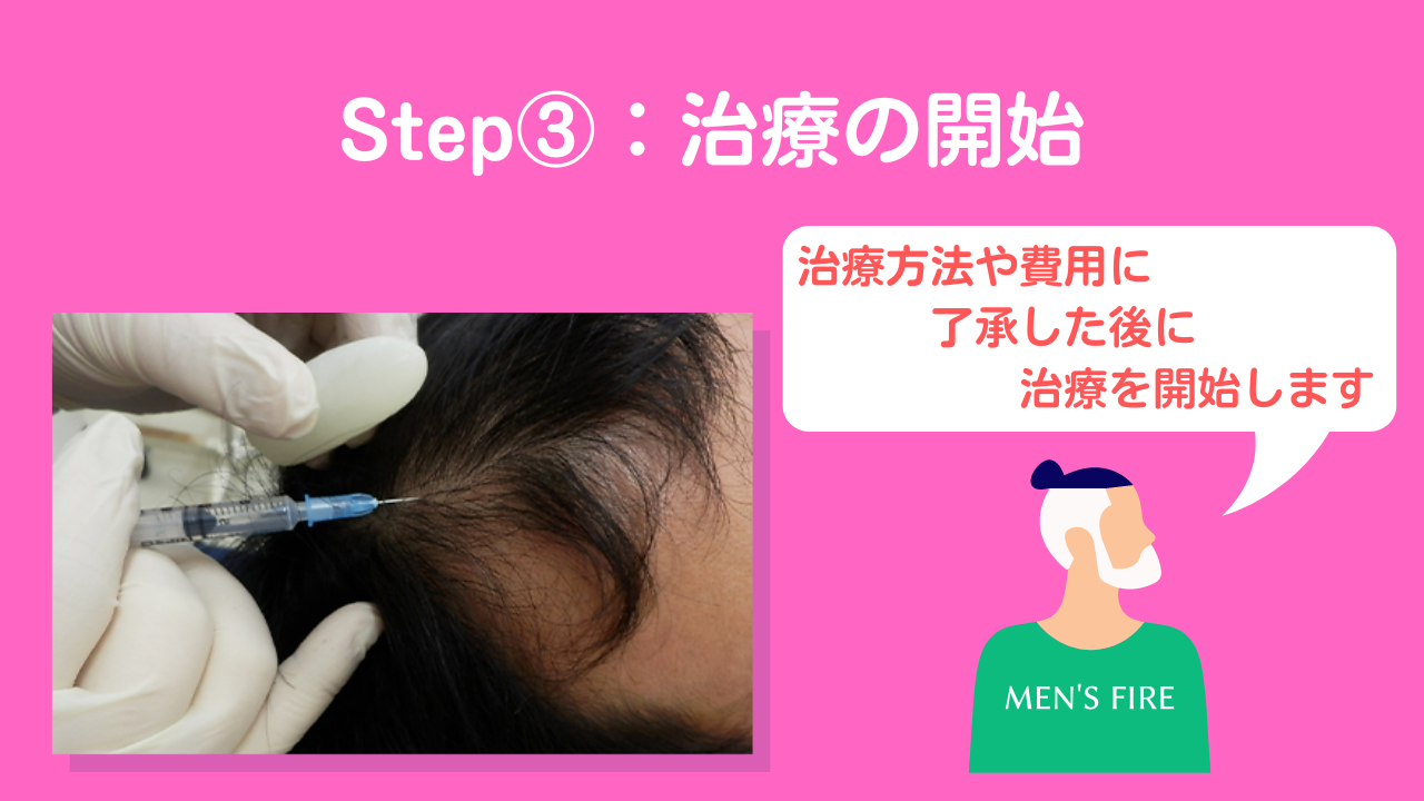 Step③：治療の開始