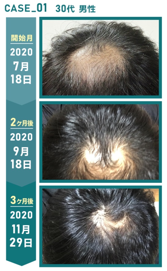 クリニックフォアでの治療結果がこちら！case1