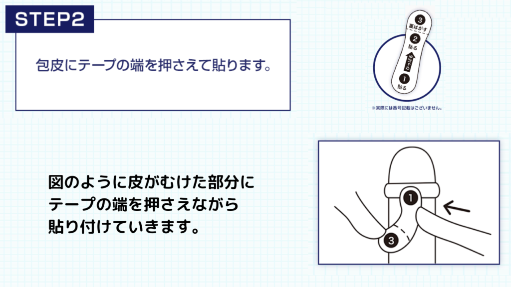 STEP②：包皮にテープの端を押さえて貼る