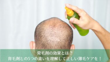 発毛剤の効果とは？育毛剤との5つの違いを理解して正しい薄毛ケアを！